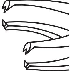 Kramer Corneal Fixation Forceps
